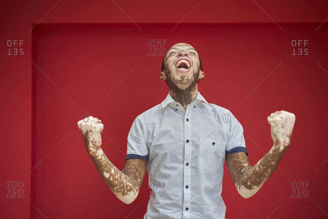 Young man with vitiligo screaming with joy and laughing on a red wall
