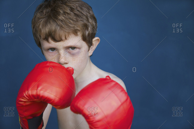 Portrait tough boy with black eye wearing boxing gloves in fighting ...