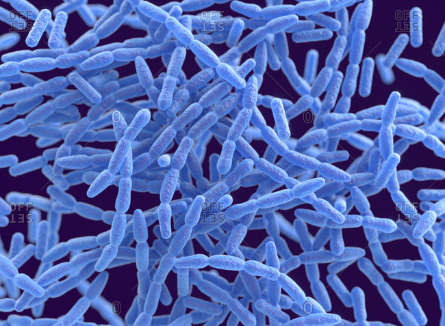 Anthrax bacteria, computer illustration. Anthrax bacteria (Bacillus anthracis) are the cause of the disease anthrax in humans and livestock. They are Gram-positive spore producing bacteria arranged in chains (streptobacilli). Many cells have a central spo