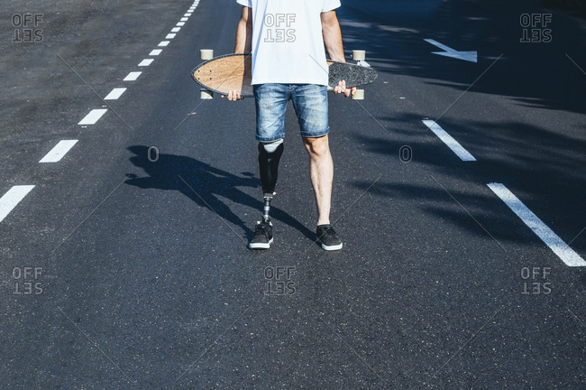 Young man with leg prosthesis holding skateboard on a road