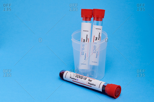 From above closeup of test tubes with blood samples in plastic cup for coronavirus diagnostic test with positive mark placed on blue background