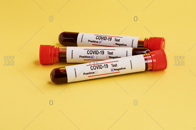 From above closeup of test tubes with blood samples for coronavirus diagnostic test with positive and negative mark placed on yellow background