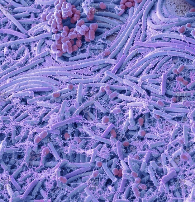 Bacteria from a coin. Colored scanning electron micrograph (SEM) of bacteria cultured from a english one pound coin. A study that tested a random selection of coins and notes of all denominations discovered the presence of 19 kinds of bacteria, including 