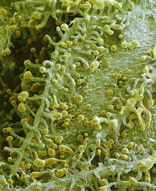 Cannabis plant. Colored scanning electron micrograph (SEM) of the surface of a cannabis (Cannabis sativa) plant. The pointed hairs are called lithocyst cells. They contain cystoliths (calcium carbonate crystals). Glandular cells called trichomes are also 