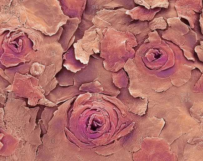Human lip. Colored scanning electron micrograph (SEM) of a human lip, showing sweat gland openings on the drier external lip surface. These openings (pores) release sweat onto the surface of the skin. This has the effect of cooling the body, as the sweat's evaporation carries away heat. Magnification x300 when printed 10cm wide.