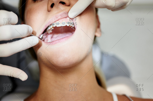 From above crop unrecognizable female dentist in gloves using mirror to check teeth of woman with braces during work in contemporary clinic