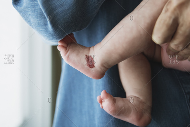 Parent holding newborn baby with focus on baby's foot with a birthmark