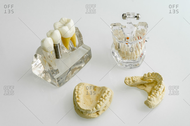 Dentures with human jaw bone on table