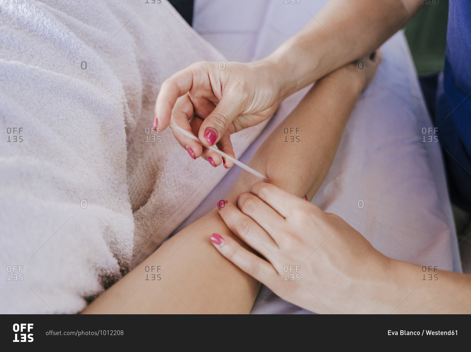 Close-up of woman inserting acupuncture needles in customer's arm on table