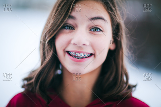 Teen Girls With Braces