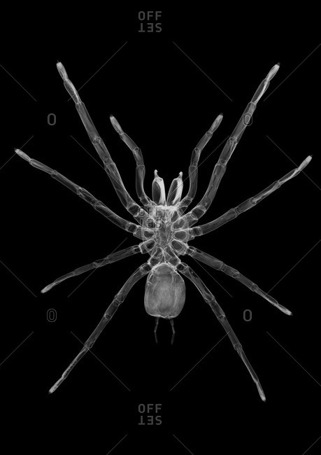 Tarantula spider (Grammostola rosea), X-ray.