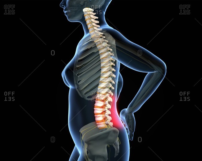 Lower back pain, illustration - Offset