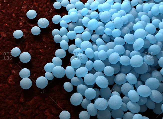 Illustration of Staphylococcus aureus (MRSA) coccoid bacteria. Staphylococcus aureus is a Gram-positive bacterium that causes food poisoning, toxic shock syndrome and skin and wound infections such as scalded skin syndrome, scarlet fever, erysipelas and impetigo. Methicillin resistant Staphylococcus aureus (MRSA) infections that are acquired by persons who have not been recently hospitalized or had a medical procedure are known as CA-MRSA (Community associated-MRSA) infections. CA-MRSA infections in the community are usually manifested as skin infections, such as pimples and boils, and occur in otherwise healthy people.