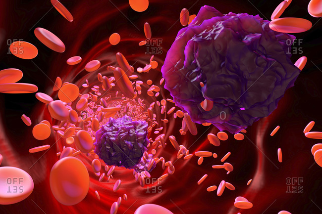 3D rendered Illustration of Leukemia cells in the blood stream