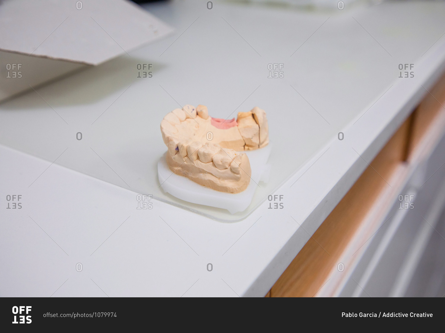 Plaster cast of jaw placed on white table in medical room of modern dental clinic