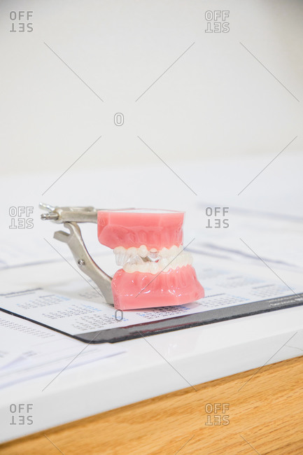 Closeup of white dental cast placed on white surface in modern laboratory