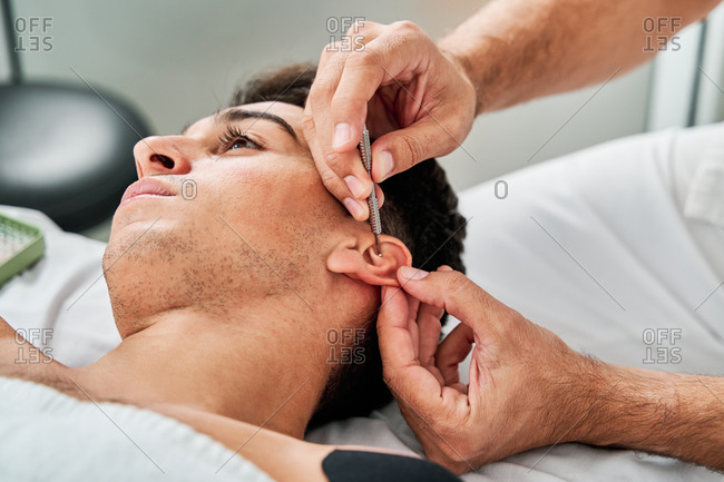 Male physiotherapist using needle on ear of client during acupuncture therapy in clinic