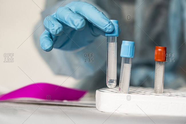 Blood research in coronavirus in laboratory