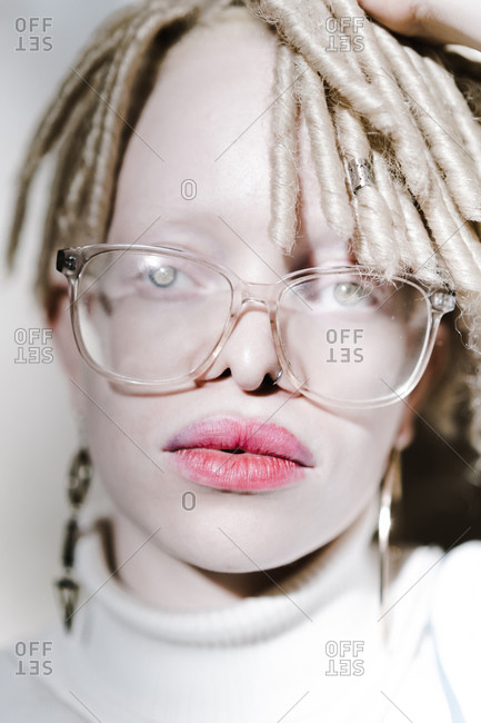 Headshot of an albino woman looking at the camera