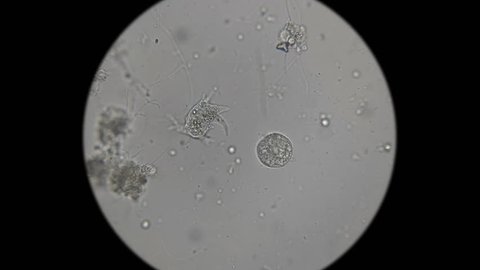 microorganisms,the inhabitants of the aquarium under the microscope,like an alien organism