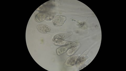 microorganisms,the inhabitants of the aquarium under the microscope,like an alien organism