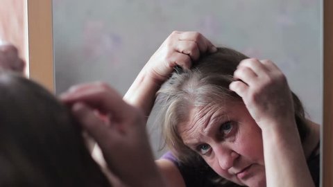 Middle-aged woman concerned by hair loss