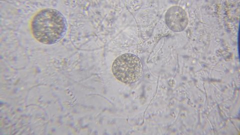 Chlamydomonas algae, paramecium ciliates and many bacteria through microscope