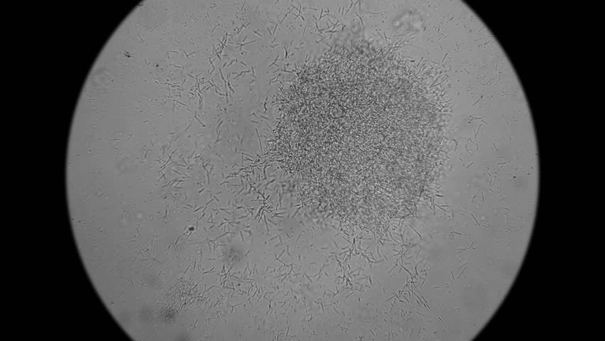 1200 кратное увеличение микроскоп attivio. Увеличение 1600 крат микроскоп. Увеличение чтобы увидеть микробов. Вирусы через микроскоп. 400 кратное увеличение в микроскоп.