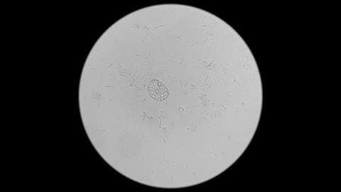 Colony Bacteriacadaveric Fingers Under Microscope Stock Footage Video