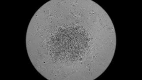 Colony Bacteriacadaveric Fingers Under Microscope Stock Footage Video