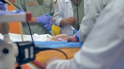 Close up of doctors performing medical procedure on a baby. 4K.