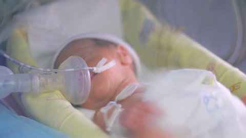 Close up of an unrecognizable new born premature baby in incubator. 4K.