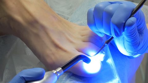 treatment of psoriasis of nails by ultraviolet