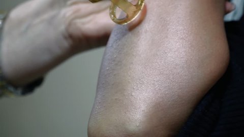 Laser hair removal and cosmetology at beauty saloon. The doctor removes hair from female hands with a photo depilatory.