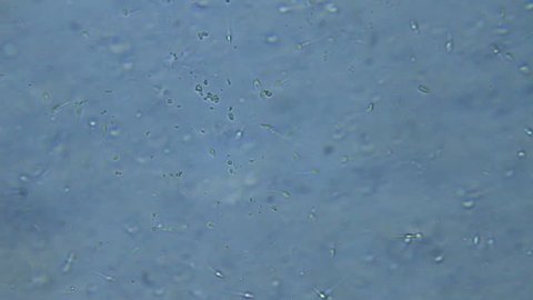 Human sperm, microscope view