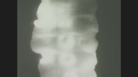 1940s: Tapeworm in strobila stage. Mature proglottids contain central row of uteri. Birth pores where eggs are released. Ribbonlike tapeworm with posterior end indicated.