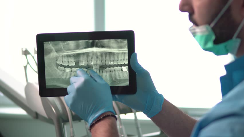Intelligent dentist showing teeth x-ray on tablet, well-built man in green mask and blue gloves explaining particular case, sitting before dental chair in light huge office Royalty-Free Stock Footage #1008348160