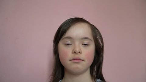 Cute smiling down syndrome girl 
