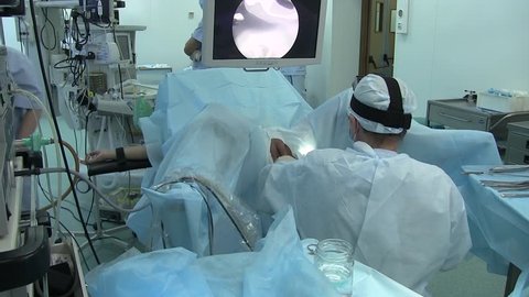 Ukraine.Kiev.28.02.20018. medicine.the surgeon performs an operation on the labia in a woman in a gynecological chair. operating table. surgical hysteroscopy operative interventions inside the uterus 
