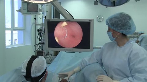 Ukraine.Kiev.28.02.2018. medicine. surgical hysteroscopy. the surgeon performs an operation on the uterus.monitor. surgical interventions within the uterus. elimination of the intrauterine device.