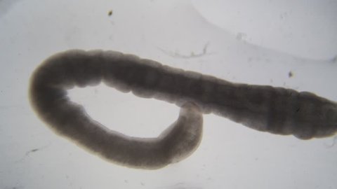 Tapeworm infection is the infestation of the digestive tract by a species of parasitic flatworm, called tapeworms under the microscope for education in Lab. 
