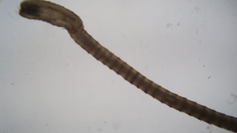 Tapeworm infection is the infestation of the digestive tract by a species of parasitic flatworm, called tapeworms under the microscope for education in Lab. 
