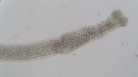 Tapeworm infection is the infestation of the digestive tract by a species of parasitic flatworm, called tapeworms under the microscope for education in Lab.