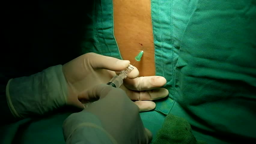 13 Lumbar Puncture Stock Video Footage - 4K and HD Video Clips |  Shutterstock