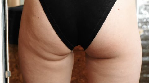 Cellulite in women booty and legs. Closeup ass women in front of the mirror in the blue trunks.