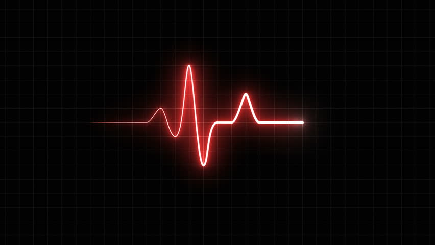 EKG 60 BPM Loop Screen, Blue w/ Grid. Heart rate… - Royalty Free Video