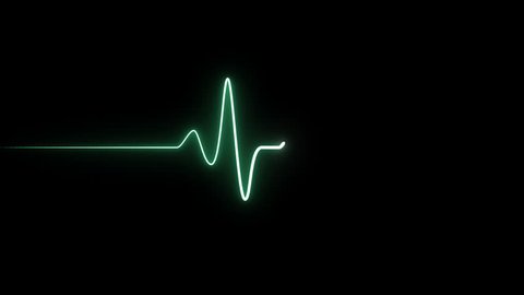 EKG 60 BPM Loop Screen, Green. Heart rate monitor / electrocardiogram (EKG or ECG) loop beeping at 60 beats per minute for screen savers or computer monitor displays, animated at 60fps.