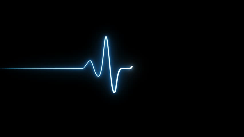 EKG 60 BPM Loop Screen, Blue. Heart rate monitor / electrocardiogram (EKG or ECG) loop beeping at 60 beats per minute for screen savers or computer monitor displays, animated at 60fps. Royalty-Free Stock Footage #1008766622