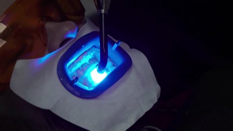 Dentist stomatologist whitening teeth for patient in medicine dental clinic with uv lamp