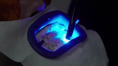 Dentist stomatologist whitening teeth for patient in medicine dental clinic with uv lamp